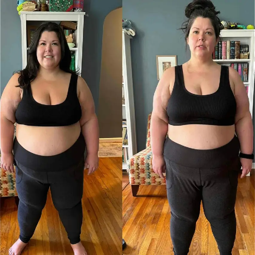 Image of a person before and after