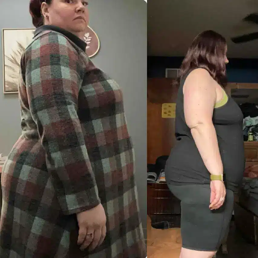 Image of a person before and after