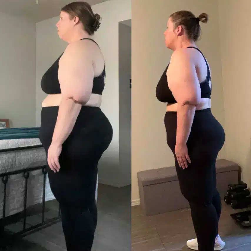 Image of a person before and after