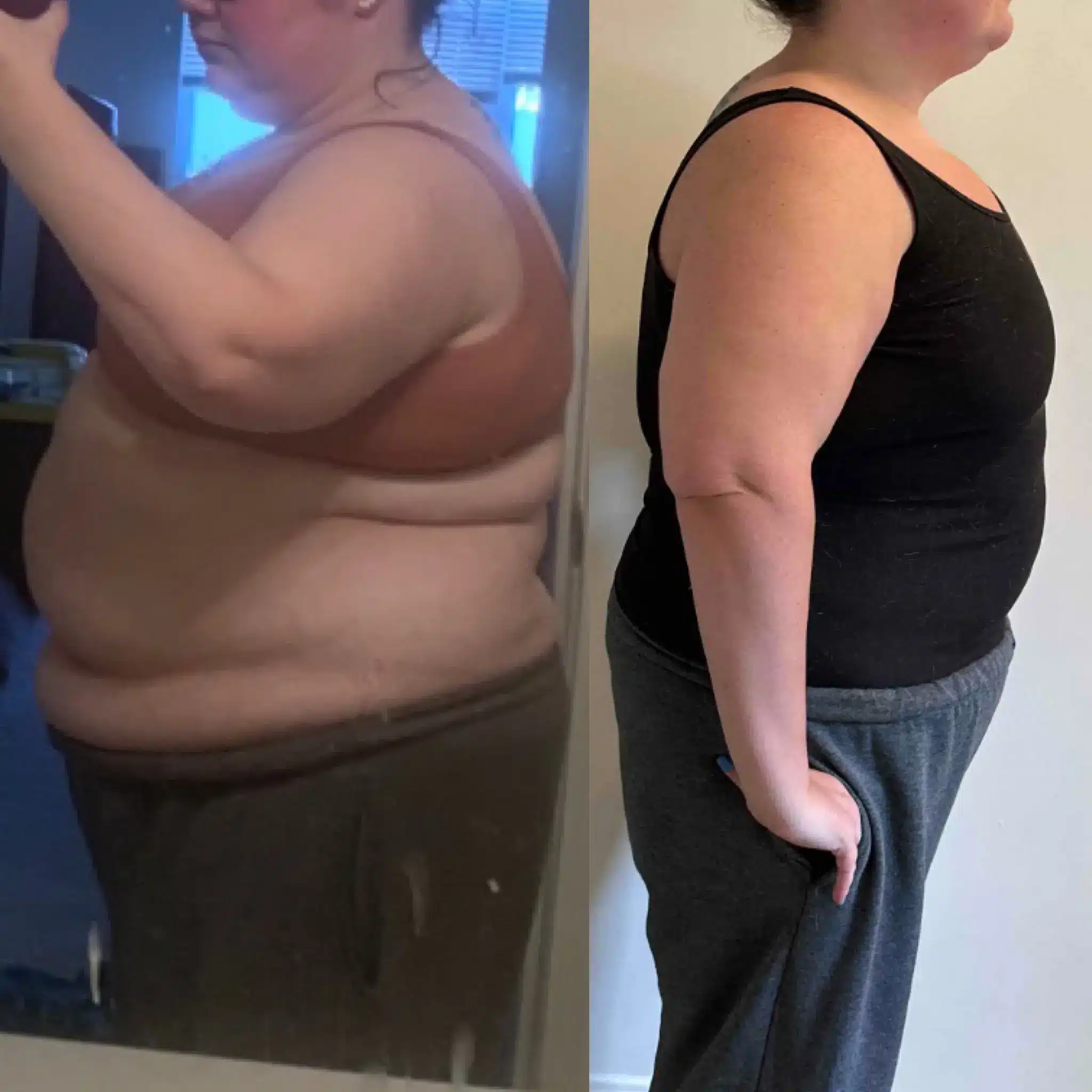 Image of a person before and after