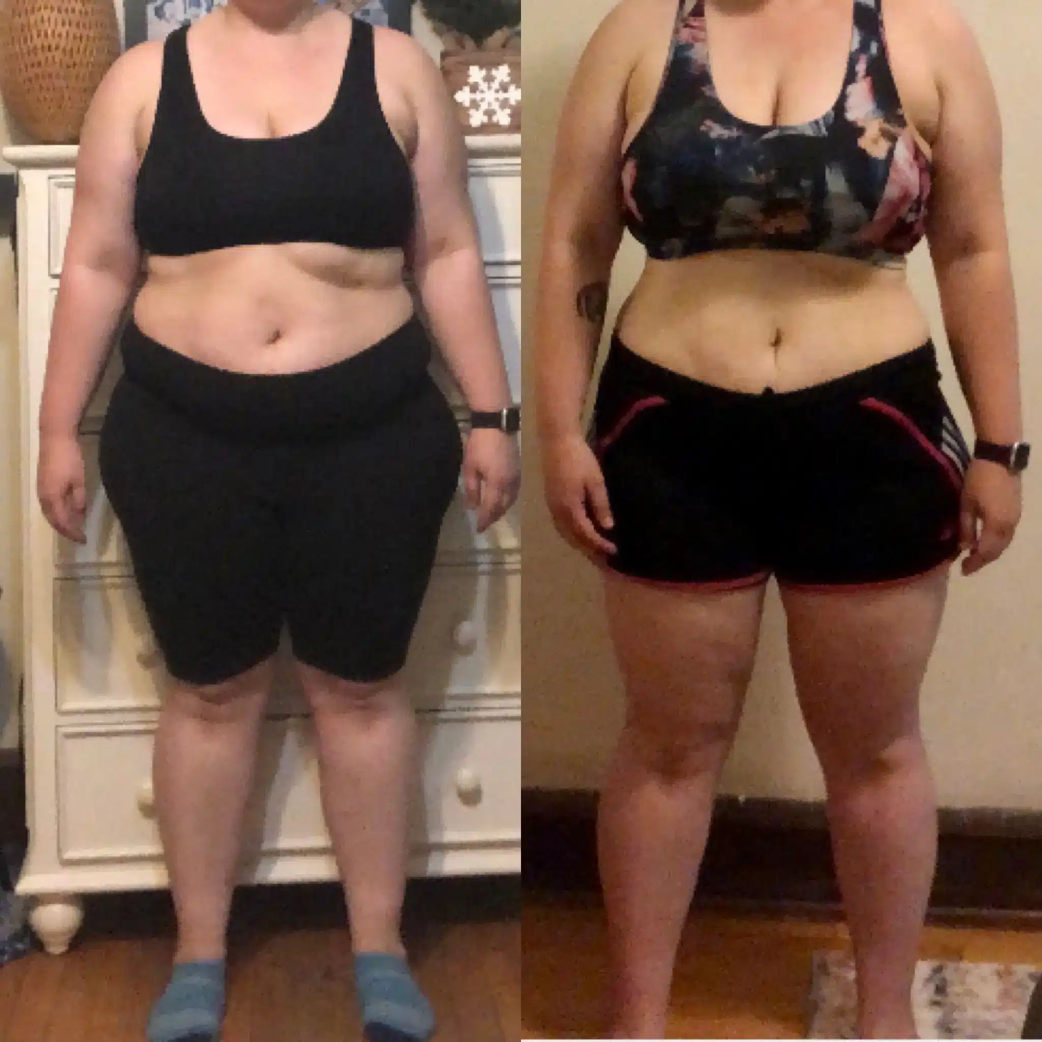 Image of a person before and after